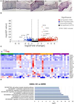 Identification of novel immune cell signature in gastroesophageal reflux disease: altered mucosal mast cells and dendritic cell profile